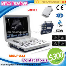 La machine à ultrasons B / W moins chère et portable pour la grossesse MSLPU33-I